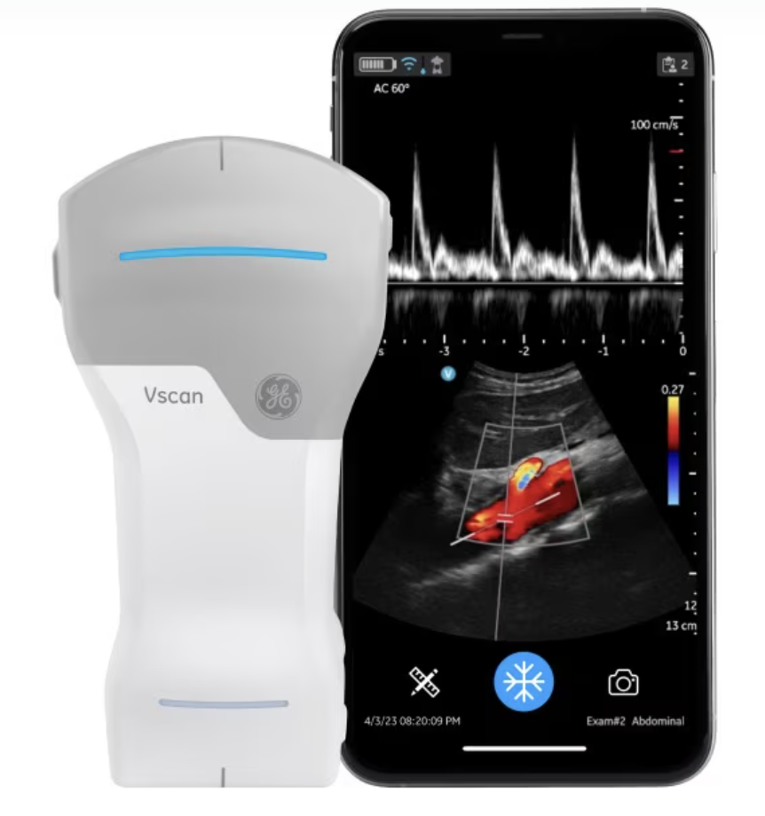 超音波装置（Vscan Air CL）