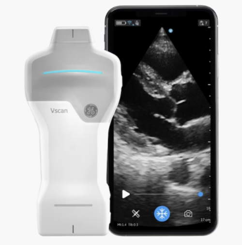 超音波装置（Vscan Air CL）